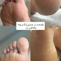 ۱ نفر ظرفیت برای کفسابی یا ژلیش یکشنبه|خدمات آرایشگری و زیبایی|رشت, گلباغ نماز|دیوار