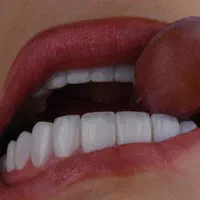 کامپوزیت دندان دندانپزشکی لمینت روکش ایمپلنت|خدمات آرایشگری و زیبایی|تهران, فردوس|دیوار