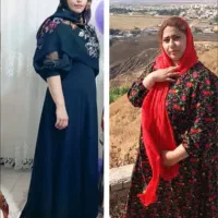 لیپو۴۵میلیون ابدو۶۵م باشرایط اقساط ساکشن غبغب۹۸۰۰
