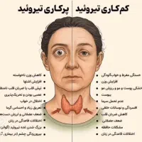 تیروئید کم کار پرکار