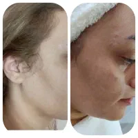 فیشیال اموزش مراقبت پوست پاکسازی ،کار ویژه یلدا|خدمات آموزشی|اصفهان, شاهزاده ابراهیم|دیوار