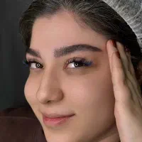 میکروبلیدینگ