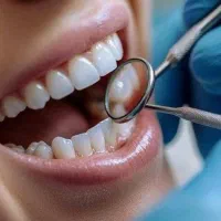 خدمات دندان با اقساط بلند مدت در کلینیک زهره