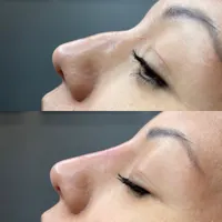 مطب‌دکترژل وبوتاکس.افزایش سایزآلت آقایان.لیفت بانخ|خدمات آرایشگری و زیبایی|قم, صفائیه|دیوار