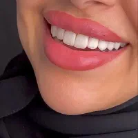 ایمپلنت / تخفیفات ویژه یلدایی