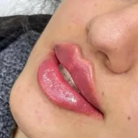آموزش ژل وبوتاکس2900.چال گونه.آموزش نخ2500.ژل بادی|خدمات آموزشی|اهواز, گلستان|دیوار