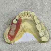 دندانسازی وساخت دندان بدون کام|آرایشی، بهداشتی، درمانی|زابل, |دیوار