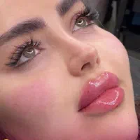 جشنواره فیلر (ژل و بوتاکس)