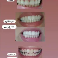 جرمگیر،اسانس میخک،خمیر دندان مسواک عطاری آقای عطار|آرایشی، بهداشتی، درمانی|زنجان, |دیوار