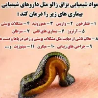 حجامت وبادکش تخصصی و زالودرمانی بادکش رشدقدی|خدمات آرایشگری و زیبایی|تهران, آهنگ|دیوار
