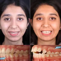 صفرتاصد خدمات دندانپزشکی اقساطی