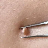 خال برداری|خدمات آرایشگری و زیبایی|قم, امامزاده ابراهیم|دیوار