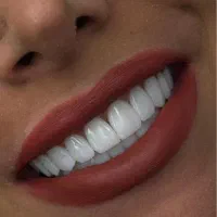 بزرگترین جشنواره تخفیفی کلینیک دندانپزشکی سرو|خدمات آرایشگری و زیبایی|تهران, قیطریه|دیوار