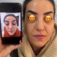 کلینیک تخصصی زیبایی/بوتاکس فیلر لاغری مزو PRP|خدمات آرایشگری و زیبایی|رفسنجان, |دیوار