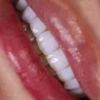 کار ما زیبایی دندان شماست