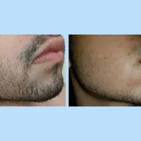 رشد کن|آرایشی، بهداشتی، درمانی|پیشوا, |دیوار