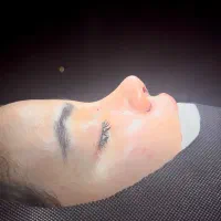 جراحی بینی/رینوپلاستی/باربی نوز تضمینی/ فقط ۱۵