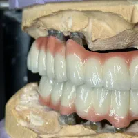 کارآموزی ،پروتز دندان(دندانسازی)