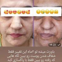 نتیجه خوبی