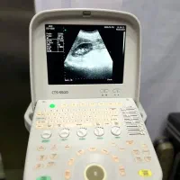 سونوگرافی siui