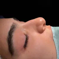 اف ویژه جراحی بینی در اهواز|خدمات آرایشگری و زیبایی|سوسنگرد, |دیوار