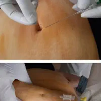 لاغری فقط بایک جلسه