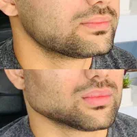 مرکزخدمات زیبایی درمانی دکتر سیدعلی پورحسینیGP