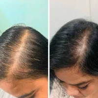 راهکار افزایش حجم