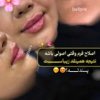 جشنواره تخفیفات تابستانه کلینیک رویال|خدمات آرایشگری و زیبایی|قدس, شهر‌قدس|دیوار