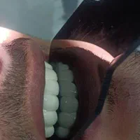 دندان سازی|خدمات آرایشگری و زیبایی|خوی, |دیوار