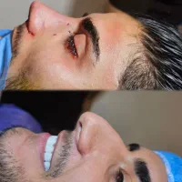 اف جشنواره عمل بینی ۲۵ت دراهوازتااخرهفته فقط