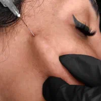ژل لب بوتاکس مزوژل فیلربادی انزیم توسط پزشک فقط۸۹۹|خدمات زیبایی و سلامت|تهران, نارمک|دیوار