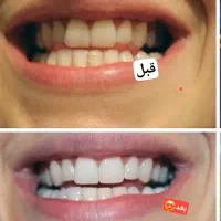 رفع ریزش مو وبرطرف کردن مشکلات پوستی