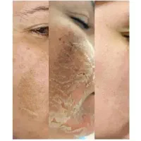 رفع تیرگی،آلگاپیل،لک صورت، پرسینگ، ژل صورت|خدمات آرایشگری و زیبایی|شیراز, سلطان آباد|دیوار