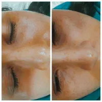 فیشیال اموزش مراقبت پوست پاکسازی ،کار ویژه یلدا|خدمات آموزشی|اصفهان, شاهزاده ابراهیم|دیوار