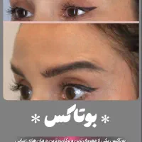 لیزرمو رفع تتوهایفو فیشال فیلربوتاکس لاغری آموزش|خدمات آرایشگری و زیبایی|فردیس, فردیس|دیوار