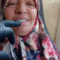 دندانسازی راشد