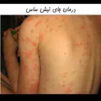 سمپاشی سم پاشی ساس سوسک کنه فقط فقط با یک جلسه|خدمات نظافت|مشهد, اروند|دیوار