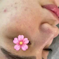 آف باورنکردنی فیشیال فوق پیشرفته اولین‌باردرایذه|خدمات آرایشگری و زیبایی|ایذه, |دیوار