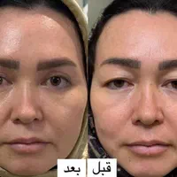 جراحی و زیبایی صورت و بدن، مزو، بوتاکس، چربی، فیلر|خدمات آرایشگری و زیبایی|کرمانشاه, |دیوار