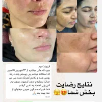 روشن کننده پوست|مواد شوینده و دستمال کاغذی|مرند, |دیوار