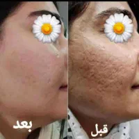 کرم Vip معجزه|آرایشی، بهداشتی، درمانی|یاسوج, |دیوار