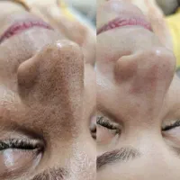 آف ۵۰ درصدی فیشیال به مناسبت روز مادر