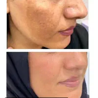 کرم اماراتی عصل مروه گلی|آرایشی، بهداشتی، درمانی|میبد, |دیوار