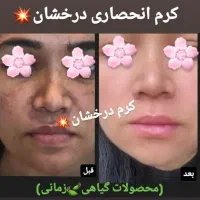 کرم ضدلک و روشن کننده درخشان(بدون بازگشت)