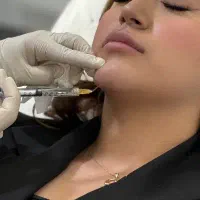 آموزش ژل و بوتاکس