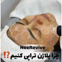 روشن سازی نواحی تیره بدن باجدیدترین دستگاه (پلاژن)