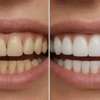دندانپزشکی دکتر نیکو فتحی
