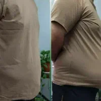 رفع چربی های شکم و پهلو به صورت کاملا گیاهی