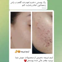 چربی سوز قوی برای شکم وپهلو|آرایشی، بهداشتی، درمانی|فریمان, |دیوار